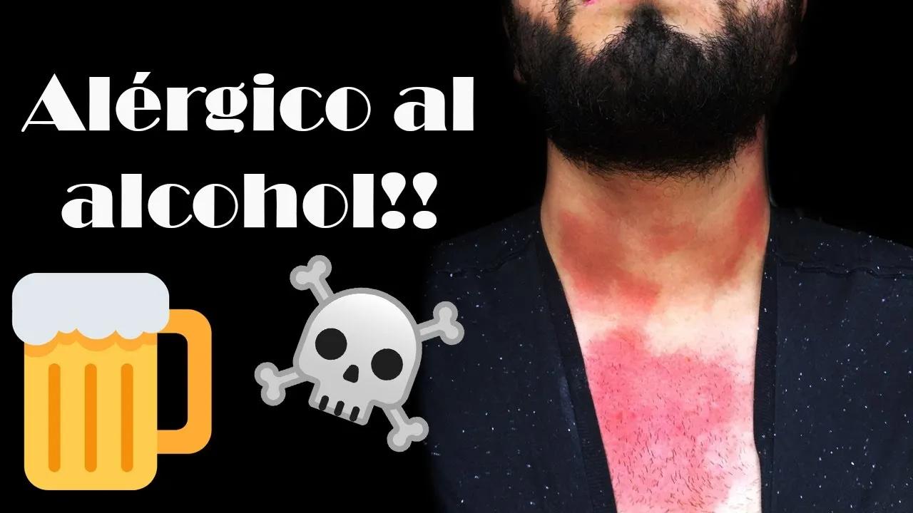 ¿Cómo saber si soy alérgico a la cerveza?