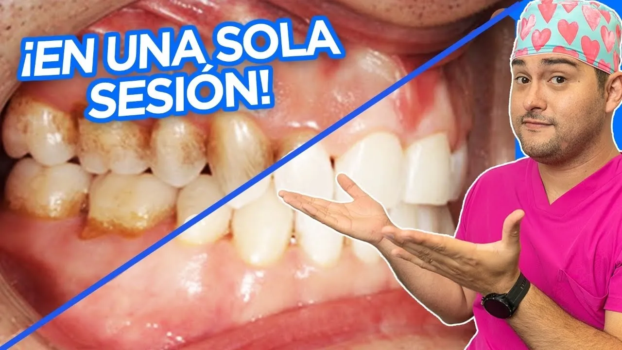 La cerveza mancha los dientes